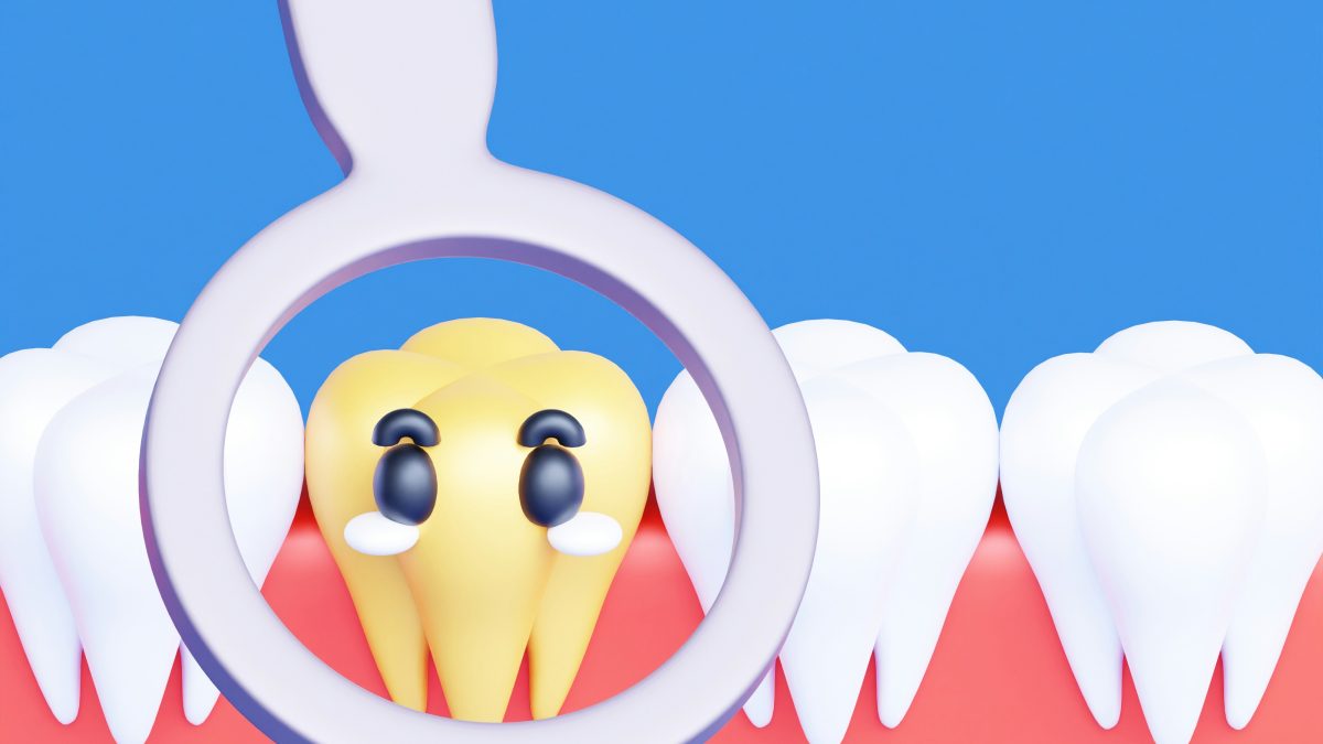Root Canals Demystified: Understanding the Procedure and Why It Saves Teeth