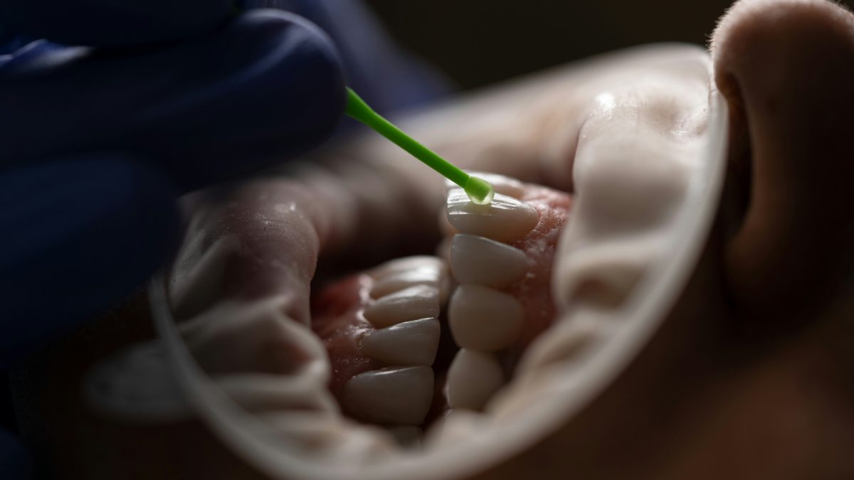 The Hidden Dangers of Teeth Grinding (Bruxism) and How to Protect Your Smile