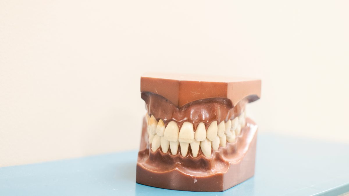 Dry Mouth (Xerostomia): Causes, Symptoms, and Effective Relief Strategies